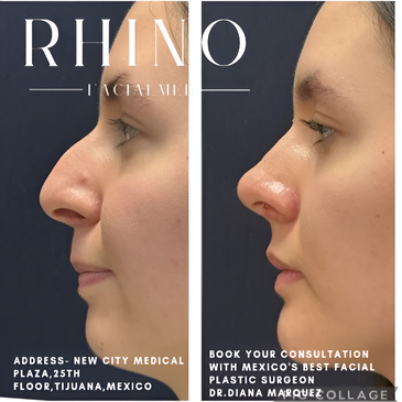 Slider image (4) Aesthetic and Oncologic Face, Head and Neck Clinic and OR